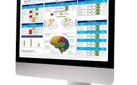 Evoke Neuroscience: Understanding The Main Types Of Memory Loss post thumbnail image